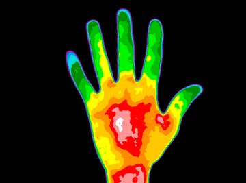 Thermal image of hand